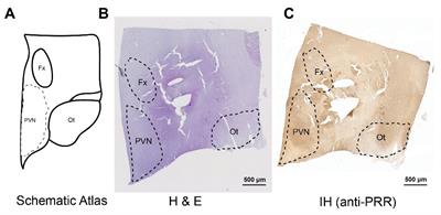 Increased (Pro)renin Receptor Expression in the Hypertensive Human Brain